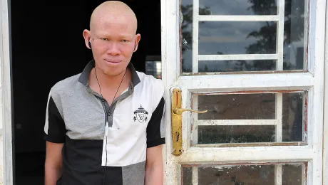 Patrick Tambure fled the Democratic Republic of the Congo with his family, because they no longer felt safe. He and four of his eight siblings have albinism. Photo: LWF/M. Renaux (2015)